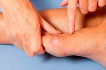 Umflături și inflamații pe picioare înainte de a folosi Hondrogel