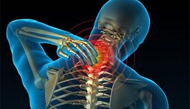 Simptomele osteochondrozei coloanei vertebrale cervicale