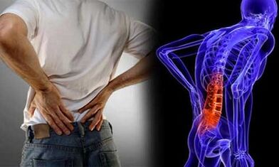 Motivele dezvoltării osteocondrozei lombare
