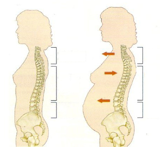 Osteocondroza în timpul sarcinii