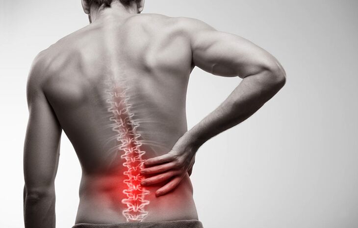 Dureri de spate cu osteocondroză